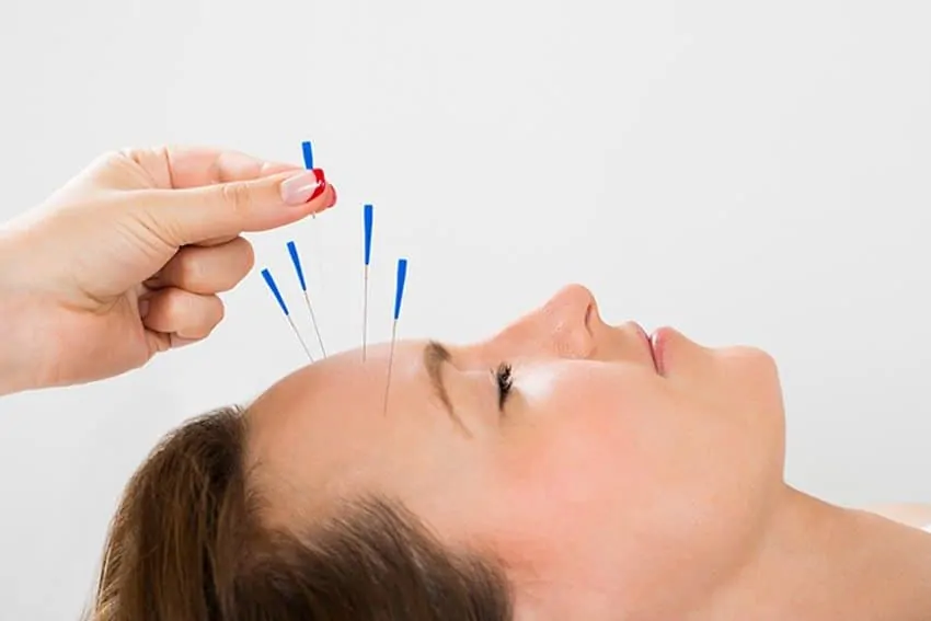 Dry Needling - Walsall Osteopath